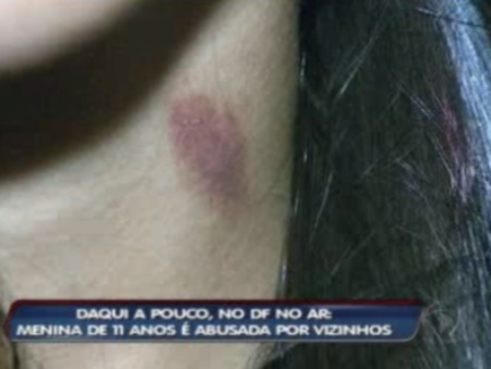 Imagem Substituída