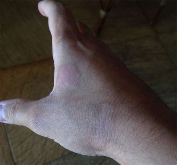 Imagem Substituída