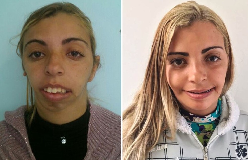Imagem Substituída