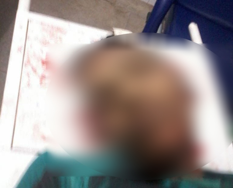 Imagem Substituída