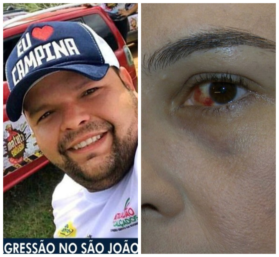 Imagem Substituída