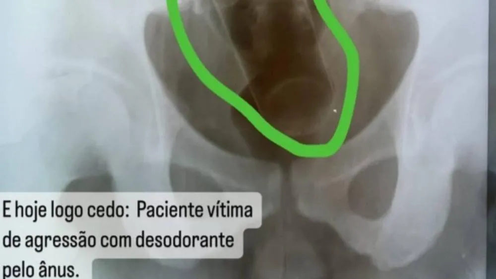 Imagem Substituída