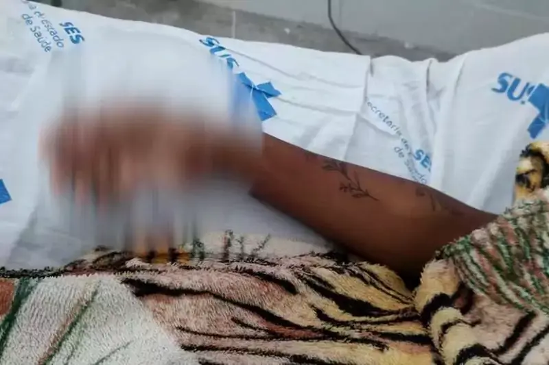 Hematomas no corpo de adolescente estuprada em Ingá
